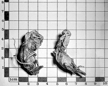 Black and white photograph of two dehydrated human foetuses lying on top of a centimetre grid before rehydration