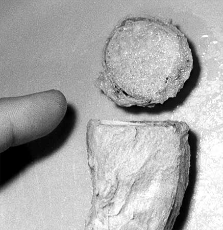 Black and white photo of the tip of Gibson's finger pointing at a freshly sliced embalmed human testicle